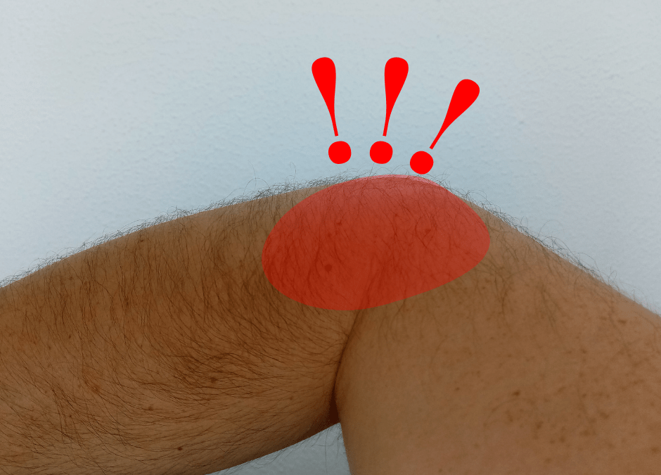 All about…Tennis Elbow